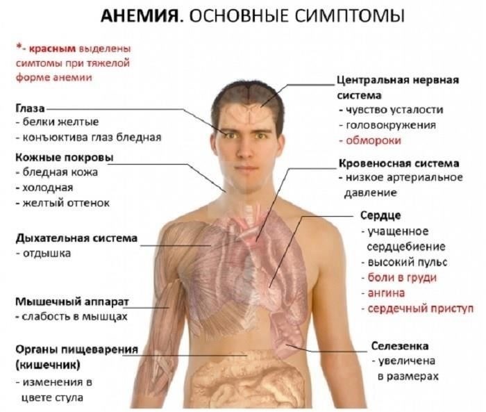 Что такое анемия и как она влияет на здоровье?