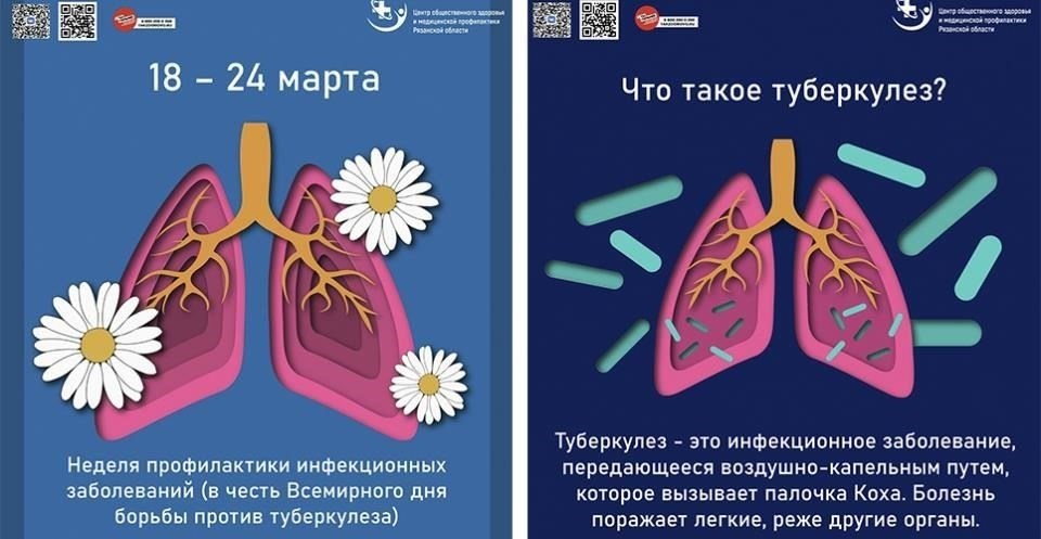 Дальнейшее обследование в процессе призыва часто выявляет такие состояния в медицинской справке. В случае выявления туберкулеза или других серьезных легочных заболеваний, согласно требованиям, изложенным в законопроекте, человек может быть исключен из числа призывников. Это решение основано на риске ухудшения здоровья в сложных военных условиях и долгосрочных последствиях для дыхательной системы.