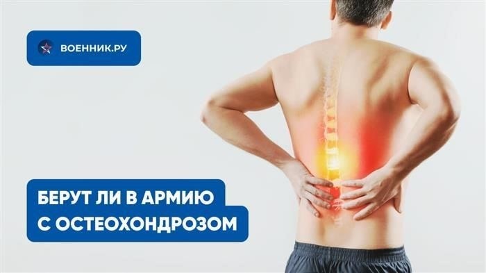 Категории годности к службе при проблемах с позвоночником