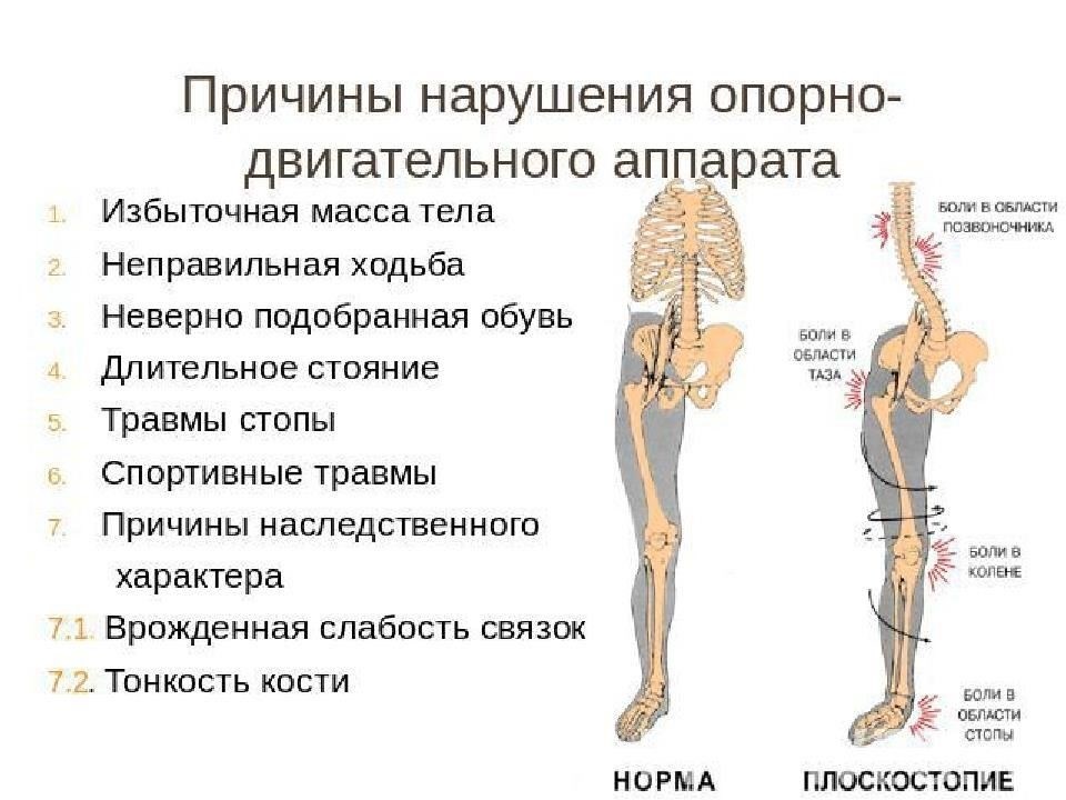 В список заболеваний входят тяжелые заболевания опорно-двигательного аппарата, такие как прогрессирующий артрит и дегенеративные заболевания суставов, при которых физические возможности человека значительно снижены. Кроме того, основанием для освобождения являются аутоиммунные заболевания, такие как ревматоидный артрит и волчанка, которые сильно ограничивают подвижность или поражают внутренние органы.